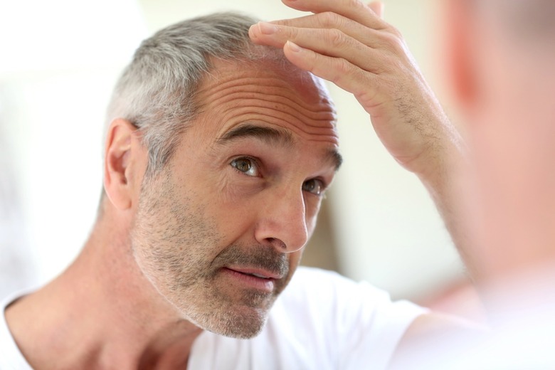 Baldness Cure