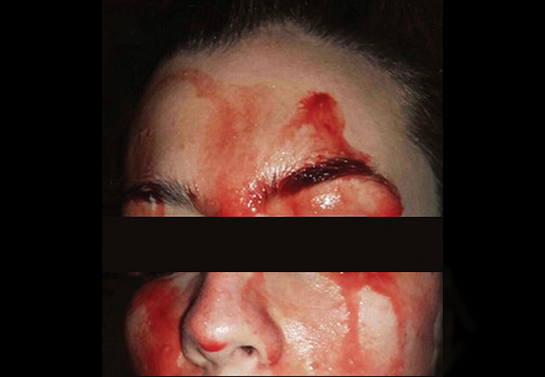 bloodsweat