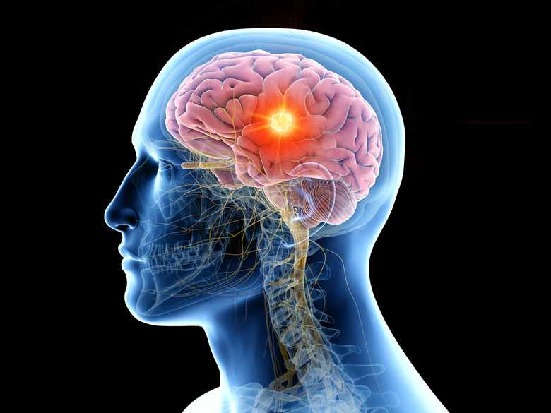 human brain scan