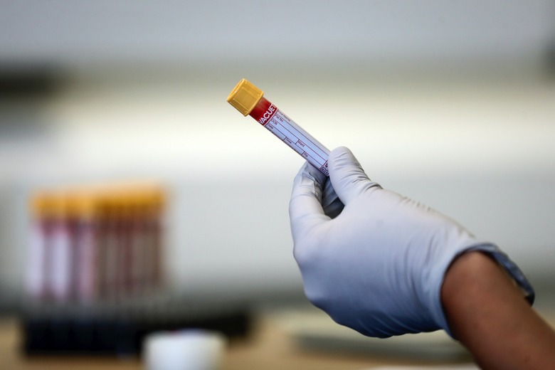 Coronavirus Vaccine