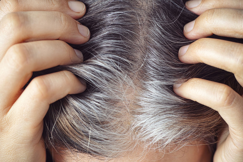 gray hair roots